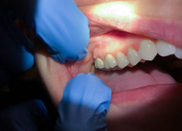 Best After-Hours Emergency Dentist in Stanaford, WV